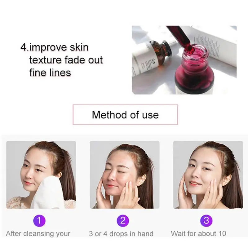 Fruit Acid AHA 30% + BHA 2% Peeling Solution Face Serum with Salicylic Acid Moisturizing Facial Skin Care 30Ml