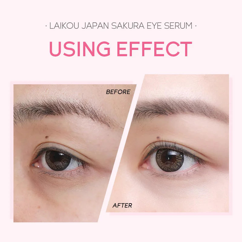 Sakura Eye Serum Eye Roller Massage Vitamin C Hyaluronic Acid Skin Care Eye Bags Cream Moisturizing Dark Circles 15Ml