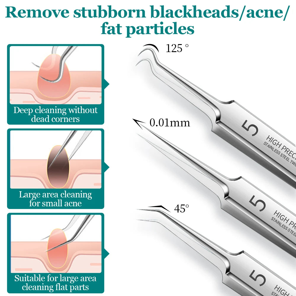 5/8PCS Acne Blackhead Removal Needles Black Dots Cleaner Black Head Pore Cleaner Deep Cleansing Tool Beauty Face Skin Care Tool